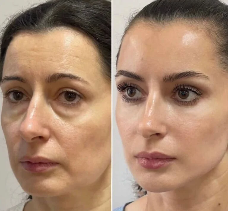 WhatsApp-Image-2026-02-18-at-17.38.30-768x711