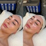 ✨-HYDRAFACIAL-✨-1-1.jpg